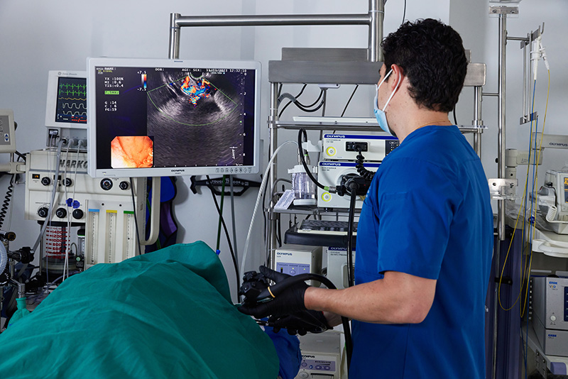 Eco o ultrasonido Endoscopico